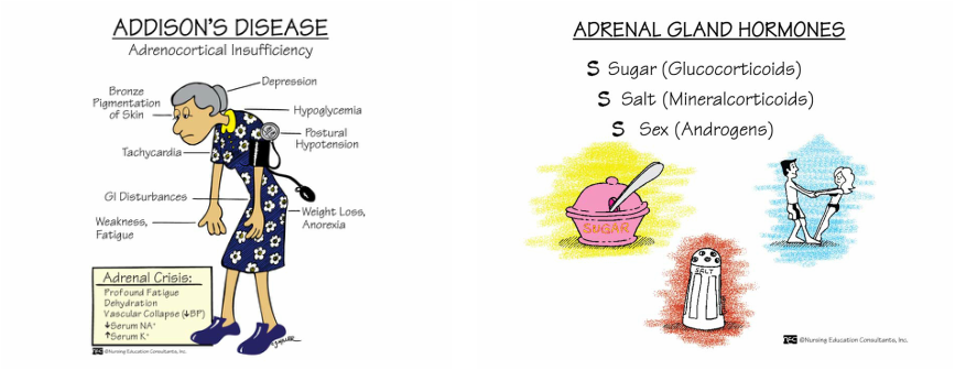 adrenal gland issues symptoms